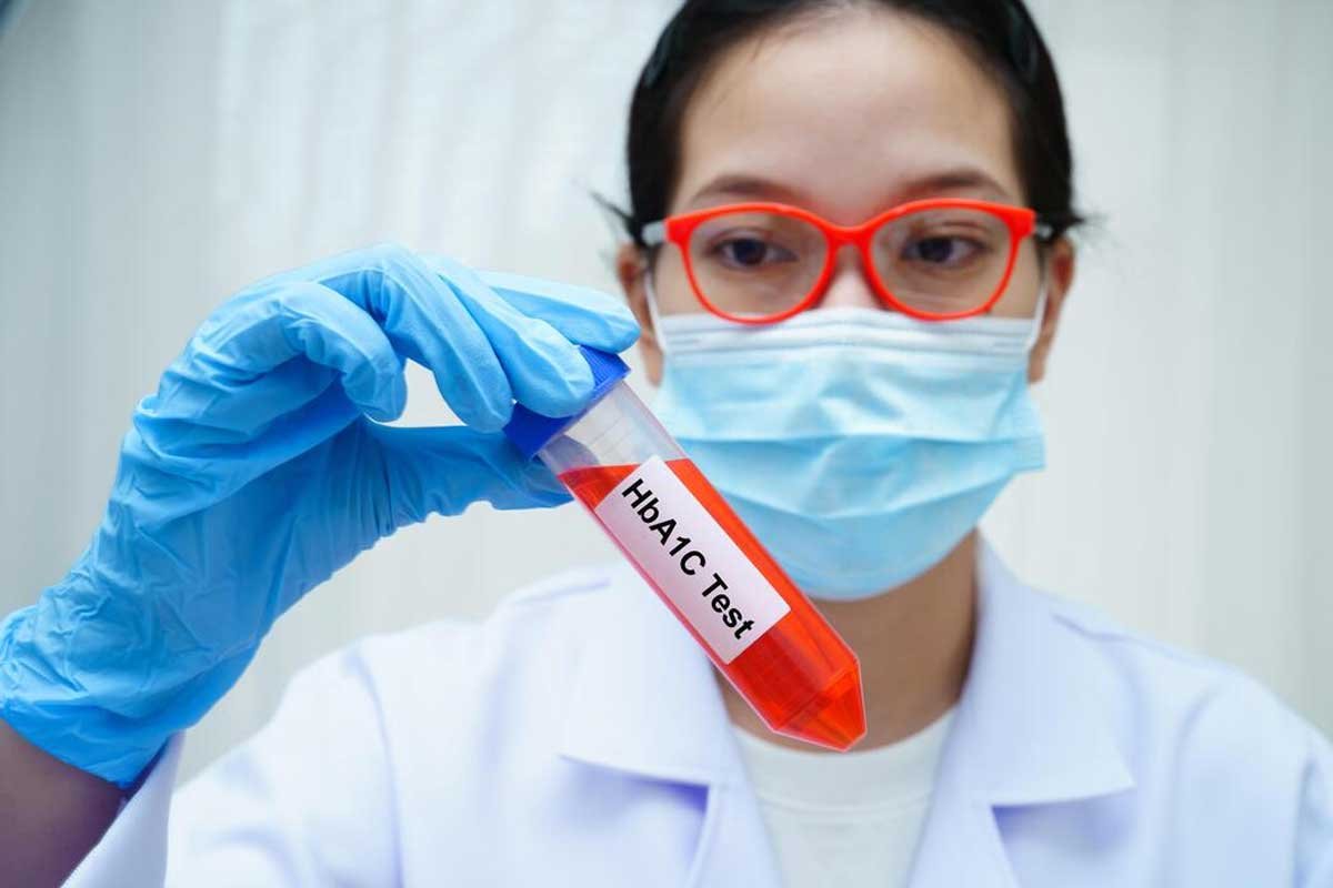 How Is Insulin Resistance Diagnosed