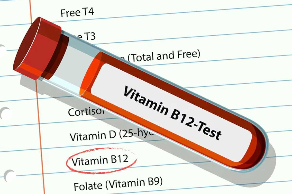 Vitamin B12 blood test