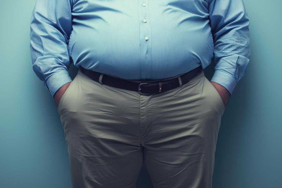 what is obesity